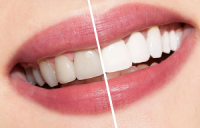 Состояние зубов во многом зависит от человека.